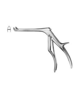 Tracheotomy